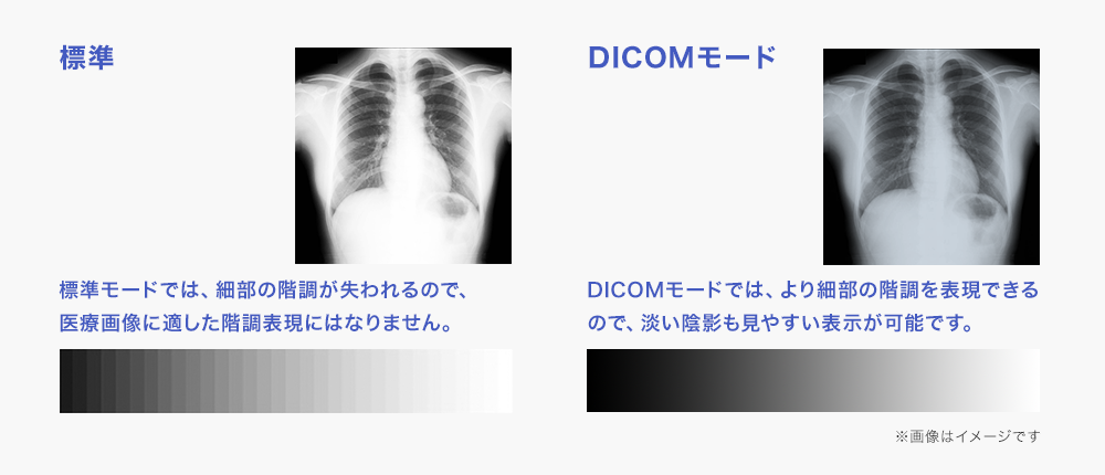 DICOM[hȂAו̊K\I